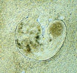 Trichobilharzia regenti in the mouse cerebellum