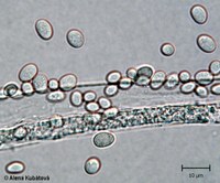 Mucor circinelloides f. lusitanicus CCF 2617, sporangiospory