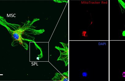 New Article about Mitochondrial Transfer is out!