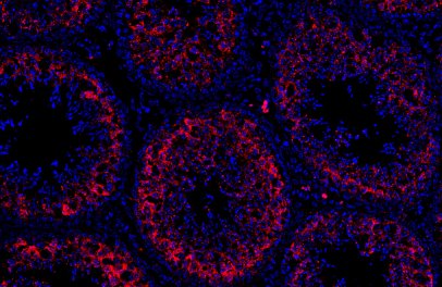 New article about Therapeutic Potential of Sertoli Cells is out.