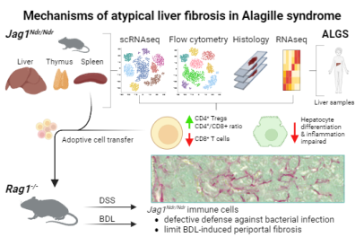 Understanding the Liver Fibrosis: Insights from Alagille Syndrome