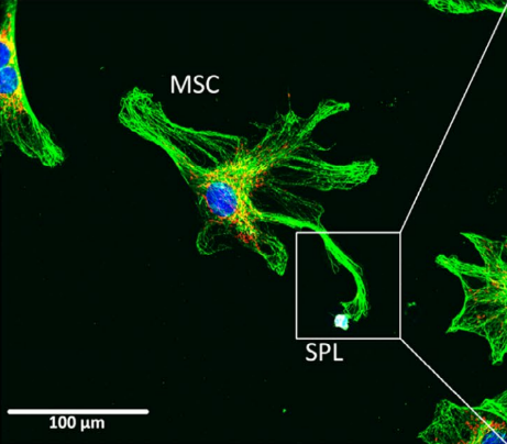 Jak přenos mitochondrií z kmenových buněk pomáhá tlumit zánět