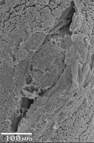 lateral root (SEM)